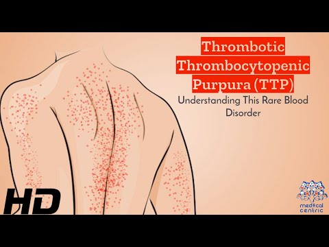 Understanding Thrombotic Thrombocytopenic Purpura (TTP)
