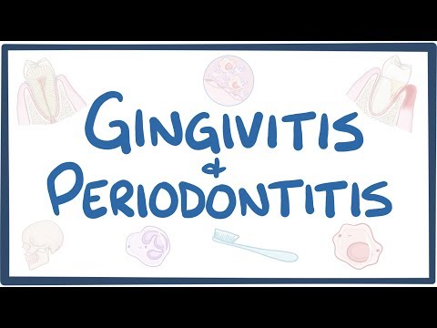Understanding Gingivitis vs. Periodontitis: Key Differences post thumbnail image