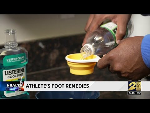 Effective Treatment for Athlete's Foot Using Hydrogen Peroxide