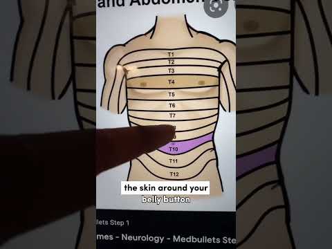 Belly Button Pain? 12 Reasons You Shouldn't Ignore