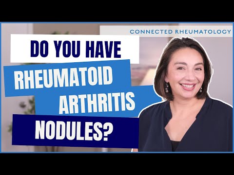 Understanding Rheumatoid Nodules: Causes and Effective Treatments