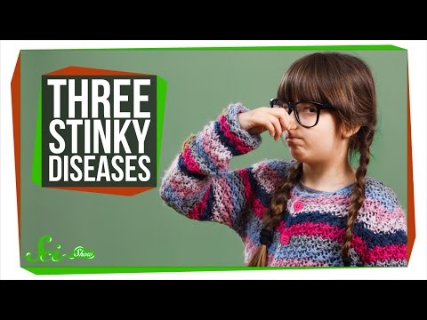 Foul Smelling Urine: Common Causes That Aren't Cancer
