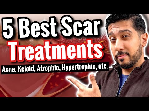 Top Scar Creams to Try in 2023 for Flawless Skin post thumbnail image
