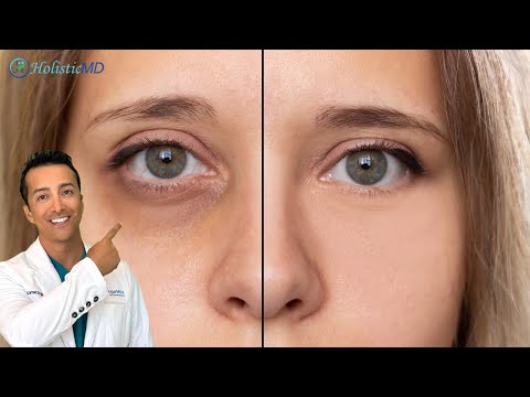 Wave Goodbye to Those Pesky Under-Eye Bags