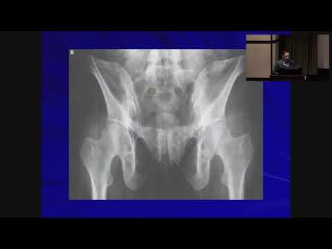 X-Ray of the Pelvis: What to Expect and Potential Risks