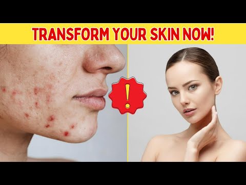 Understanding the Health Benefits of Mandelic Acid for Skin Care post thumbnail image