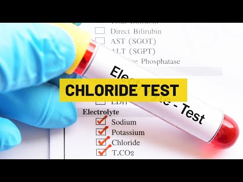 What You Should Know About the Chloride Test