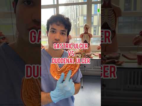 Gastric vs. Duodenal Ulcers: Key Differences Explained