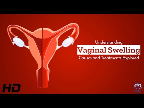 Understanding Vaginal Soreness: Causes and Effective Treatments