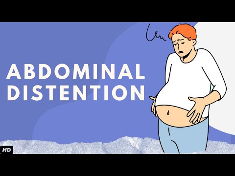 Understanding Why Your Abdomen Swells and Bloats