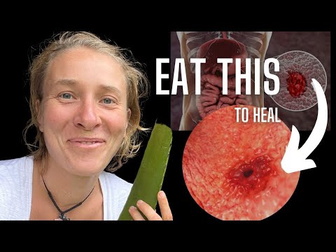 Essential Ulcer Diet: Foods to Embrace and Avoid for Relief