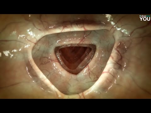 Inside the Digestive System: A Closer Look at Its Parts