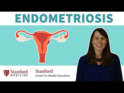 Endometrioma Explained: Treatment Options and Future Outlook post thumbnail image