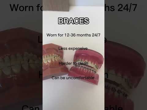 Braces Costs Broken Down: Age, Type, Insurance, and More
