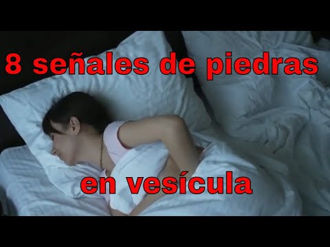 7 Remedios Naturales para Aliviar el Dolor de Vesícula Biliar