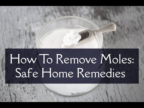 When Should You Consider Removing a Mole for Your Health?