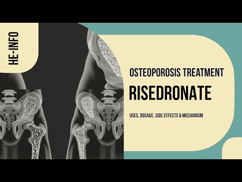 Risedronate: Side Effects, Dosage, Uses, and Insights post thumbnail image