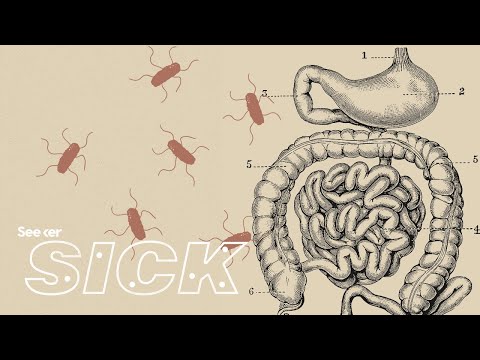 Understanding Typhoid Fever: Is It Contagious?