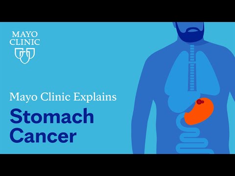Understanding Gastric Cancer: Types, Symptoms, and Causes