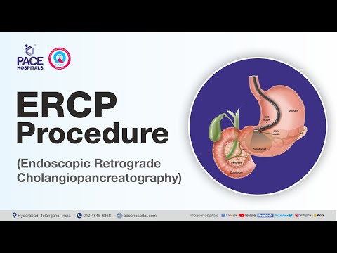 Understanding Digestive Diseases Through ERCP Testing post thumbnail image