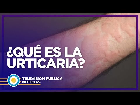 Erupciones cutáneas: Causas, tipos y tratamientos efectivos