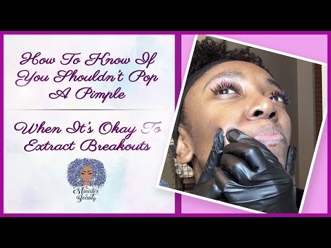 Safe Ways to Pop Blackheads: Essential Instructions and Tips