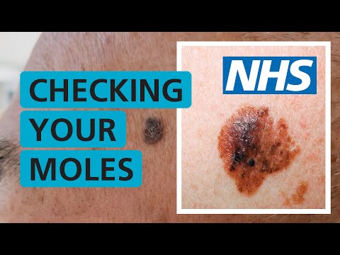 Identifying Common Skin Growths: Are They Malignant or Benign? post thumbnail image