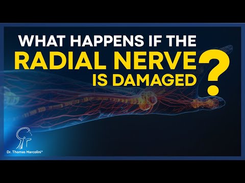Understanding Radial Nerve Injuries: Causes and Solutions