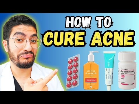 Understanding Acne Treatment Cream: Benefits and Side Effects
