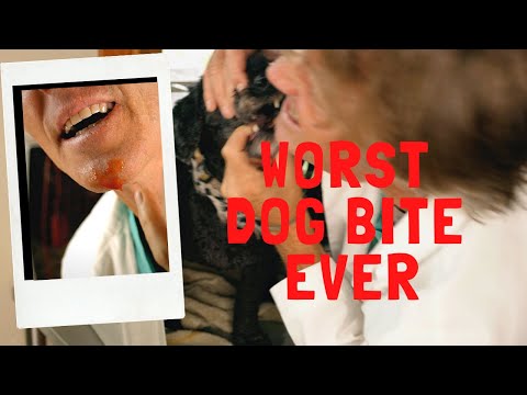 Essential Steps for Proper Dog Bite Treatment and Care
