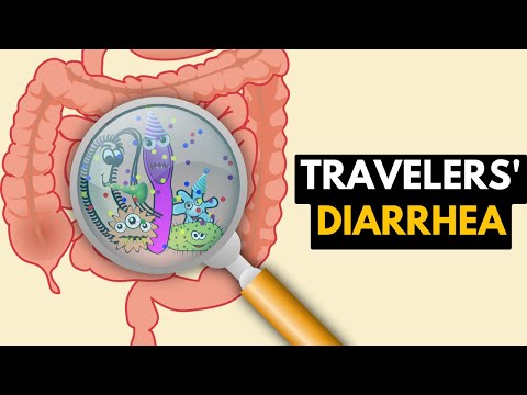 Understanding Traveler’s Diarrhea: Treatment and Prevention Tips post thumbnail image