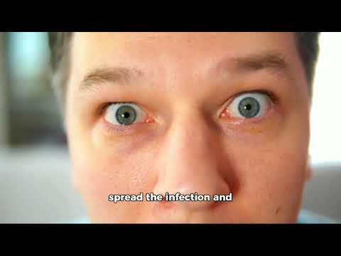 Say Goodbye to Styes: Effective Remedies and Treatments post thumbnail image