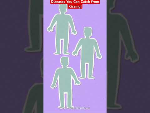 Can You Catch Gonorrhea From Kissing? Key FAQs Answered