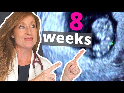 What to Expect at Your 8-Week Ultrasound Appointment