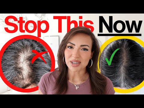 22 Proven Strategies to Prevent Hair Loss Today post thumbnail image