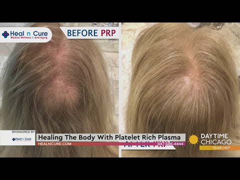 Rejuvenate Your Body with Platelet-Rich Plasma Injections