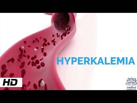 Recognizing Hyperkalemia: Key Signs and Symptoms to Notice