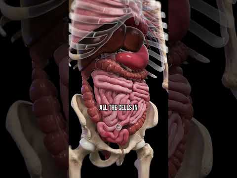 Key Insights on Diverticulitis: Causes and Effective Treatments
