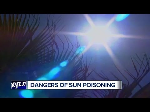Sun Poisoning: Recognize Symptoms and Find Relief Today