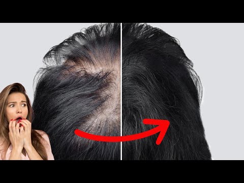 Is Grapeseed Oil an Effective Treatment for Hair Growth?