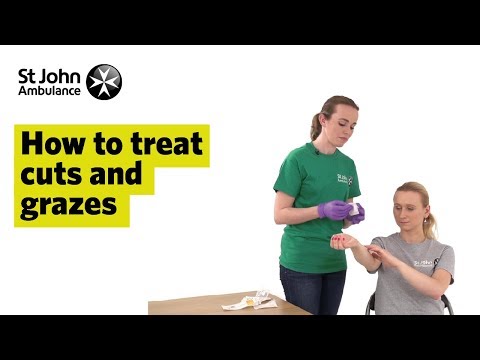 Essential First Aid for Treating Hand Injuries Safely