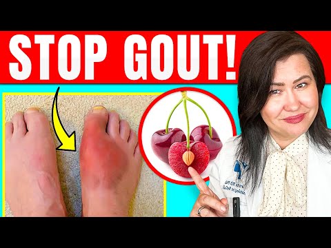 Natural Gout Remedies You Can Try at Home for Relief post thumbnail image
