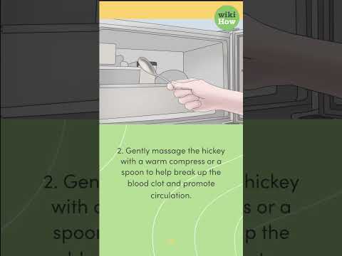 Say Goodbye to Hickeys: 10 Clever Ways to Hide Them