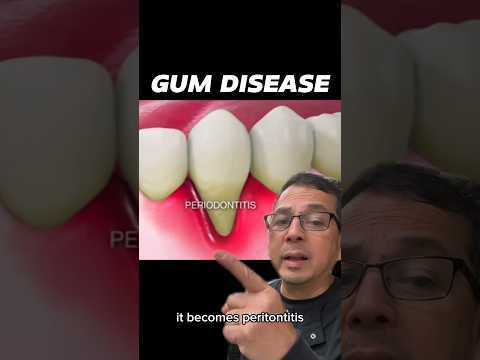 Understanding the Role of a Periodontist in Dental Care post thumbnail image