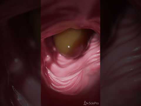 Understanding the Colon: Anatomy and Its Vital Functions