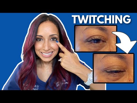 Understanding the Mystery Behind Eye Twitching