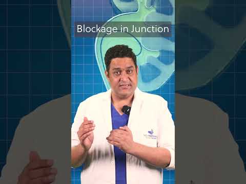 Understanding Ureteropelvic Junction Obstruction: Symptoms and Care post thumbnail image