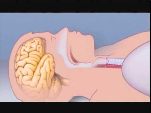 Understanding Oversleeping: Causes and Health Risks Explained