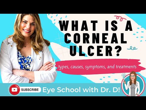 Understanding Keratitis: Types, Symptoms, and Treatments