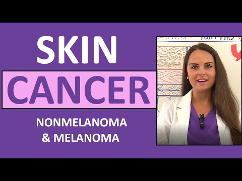 Understanding Basal Cell Carcinoma: Symptoms and Solutions